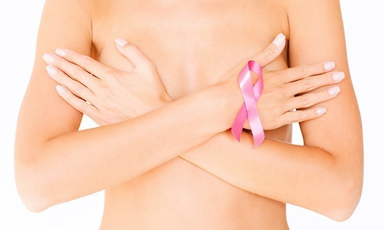 Prednosti testiranja BrcaTrue testom